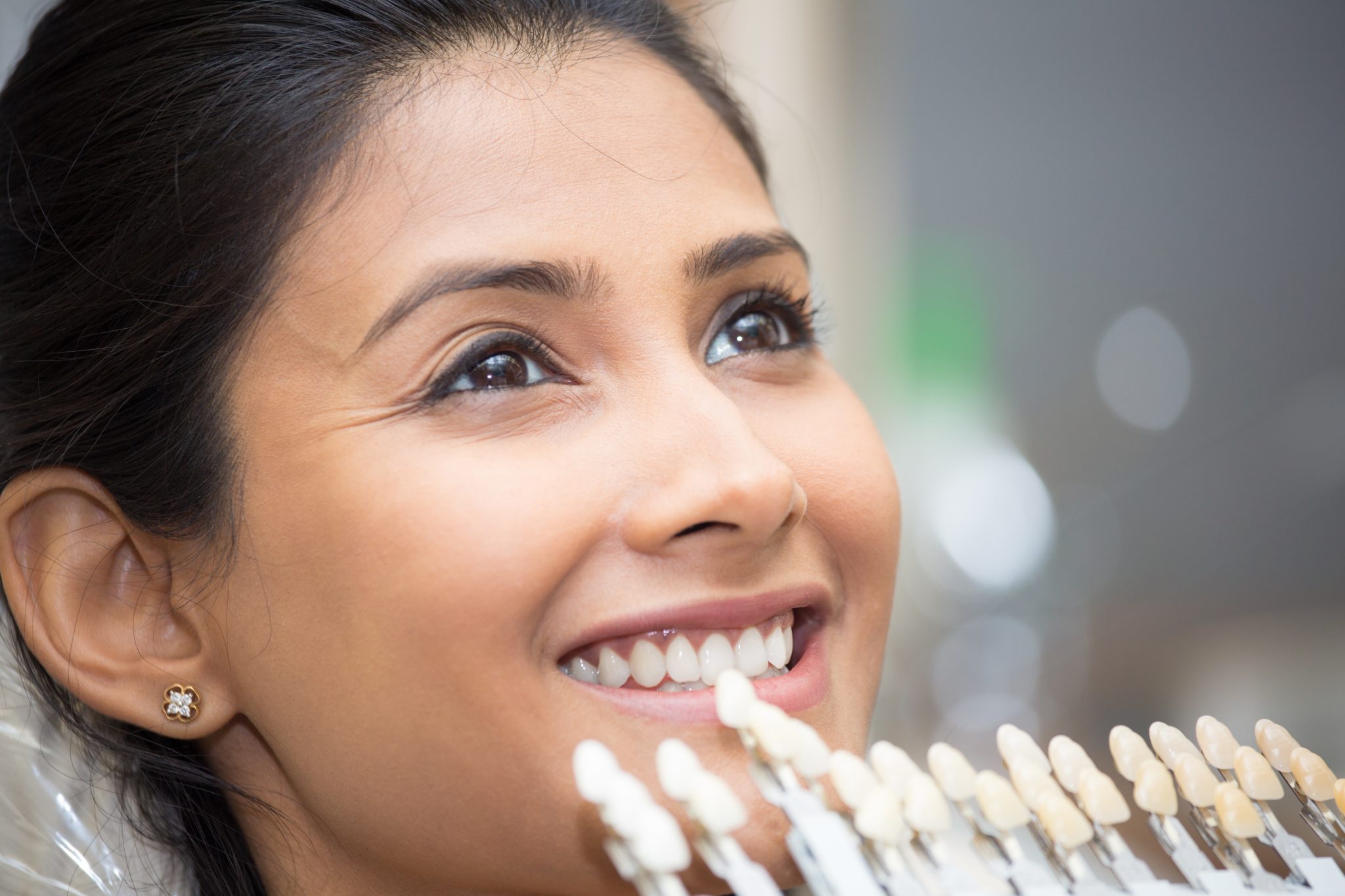 Shade Guide To Teeth, Selection Process